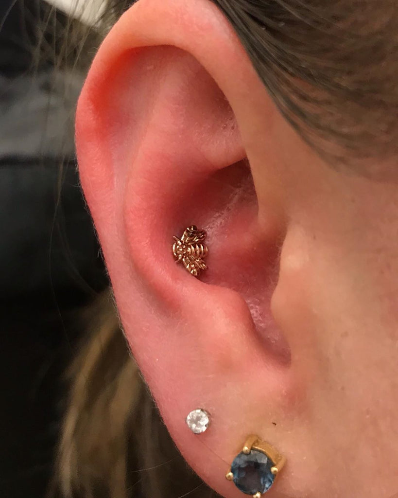 Irritated conch piercing: pierced with a stud about 4 months ago, two weeks  ago changed it to a ring. skin is puckering up around the ring, bump on the  back. Any recommendations
